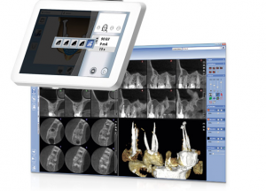 Planmeca 3D CT-röntgen