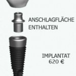 zahnimplantat zahnbehandlung