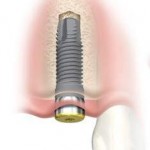 dental-treatment-abroad