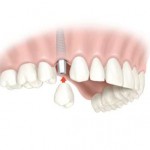 dental-treatment-abroad-2