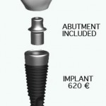 implant-english