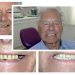 picture-dental
