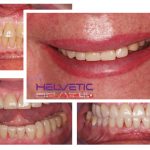 Helvetic-Dental-klinik-Hotel