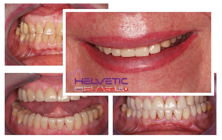 Helvetic Dental klinik Hotel